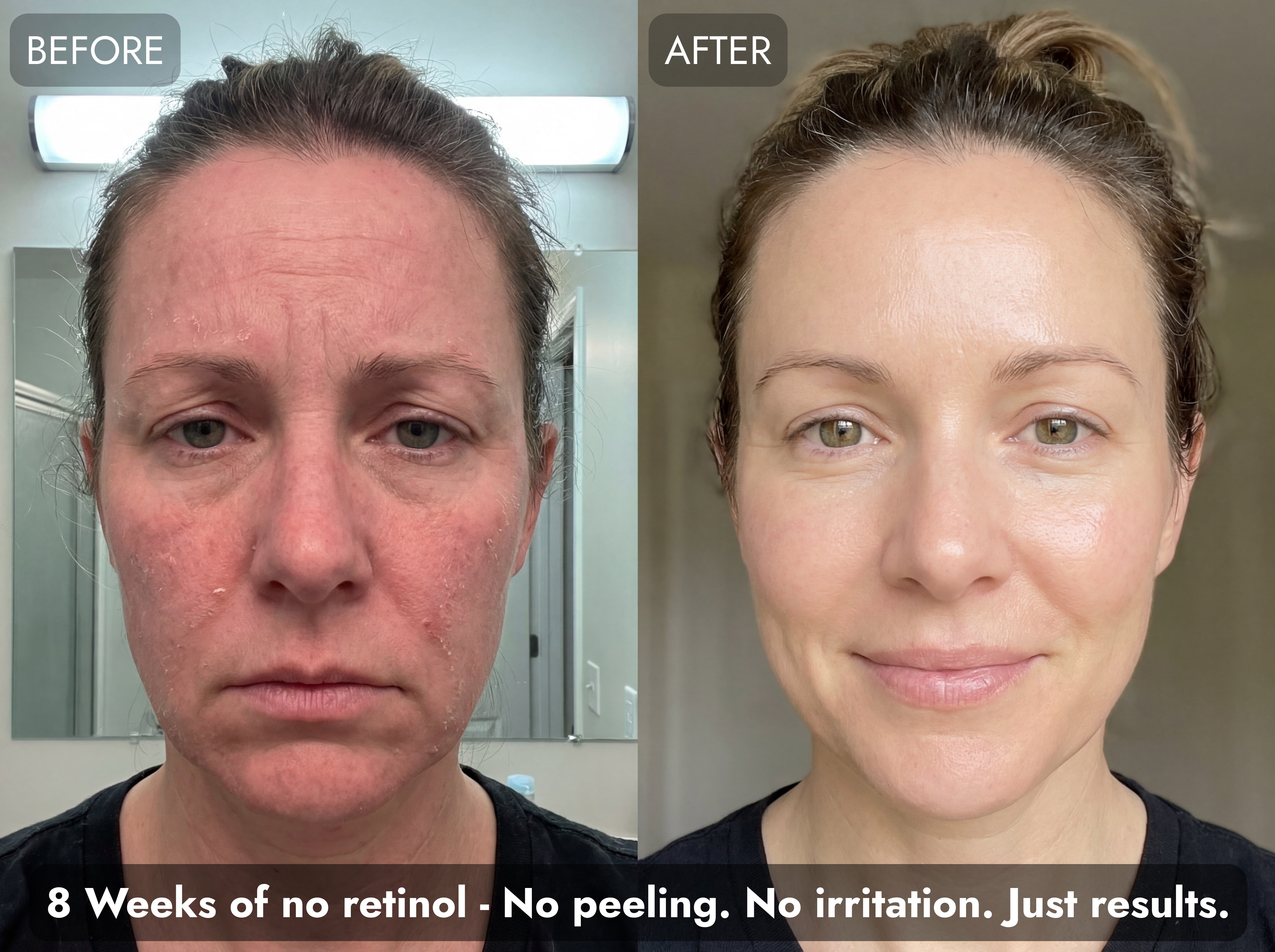 Before and after GHK-Cu copper peptides — 8 weeks, no retinol