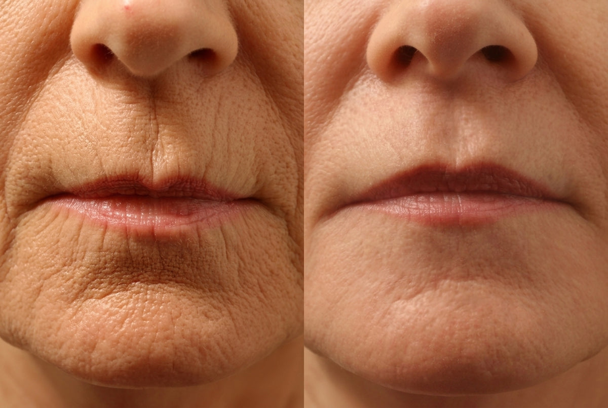 Lower face, mouth and lip line